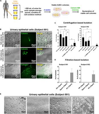 Urine Sample-Derived Cerebral Organoids Suitable for Studying Neurodevelopment and Pharmacological Responses
